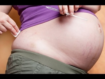 Pigmentáció a terhesség a szervezetben okoz, hogy hogyan kell kezelni