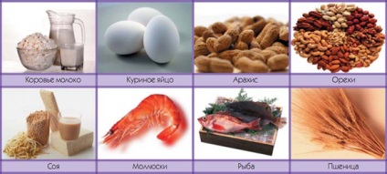 Élelmiszer allergia okozza, tünetei, kezelése ételallergia