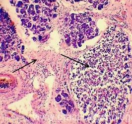 Pancreasul este o practică a unui histolog