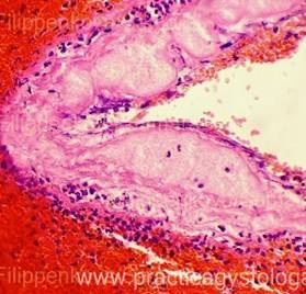 Pancreasul este o practică a unui histolog