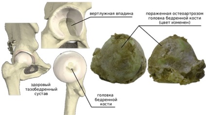 Shutkin Yuri Petrovich endoprotetice ale articulațiilor șoldului
