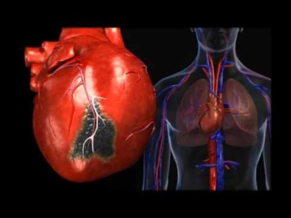 Ierburi pentru inimă și cerebrale Tratamentul bolilor cardiovasculare prin medicina pe bază de plante