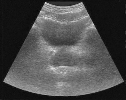 Metode de examinare cu ultrasunete
