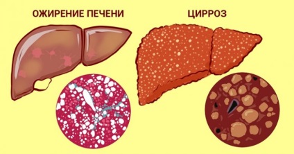 5 gyógynövény népi receptek a májra