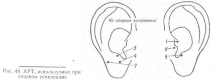 Tratamentul blefarospasmului, determinarea cauzelor, neurologie