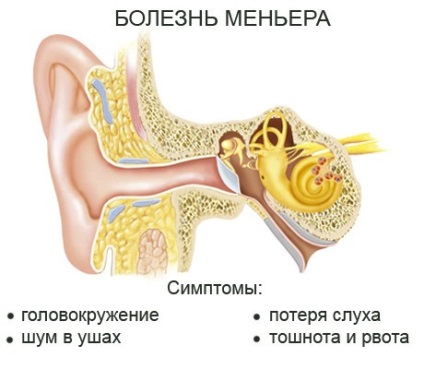 Boala formelor mai mici - cauze, simptome, tratament