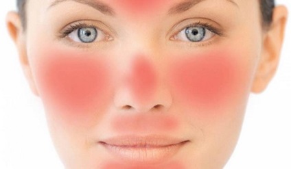 Curățați fața cu indicații sifonice, contraindicații, măști și recenzii