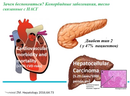 Деца неалкохолен мастен черен дроб (NAFLD)