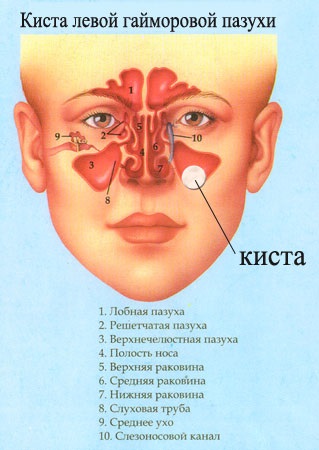 Rinichirurgia endoscopică