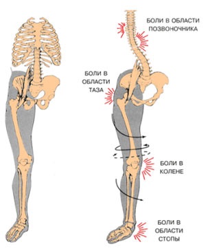 Formotiks individuale ortopedice pentru insolati - clinica 
