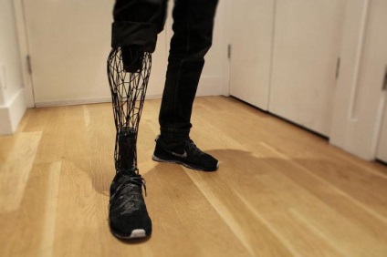 Care sunt protezele pentru picioare și descrierea - viața mea