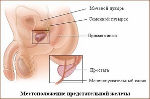 Cum să luați Nitroxoline cu prostatită