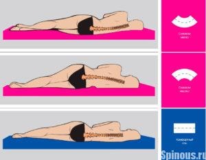 Hogyan válasszuk ki a matrac osteochondrosis ajánlások