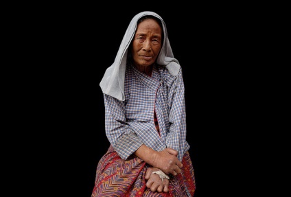 Cum trăiesc leprosii în lumea societății foto din Nepal