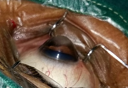 Keratoglobus és fő jellemzői, lehetőség gyógyító és megelőző intézkedések (Keratoglobus) Keratoglobus és fő jellemzői, lehetőség gyógyító és megelőző intézkedések