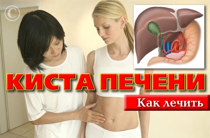 Chistul ficatului - cauzele, simptomele, diagnosticul și tratamentul, care sunt chisturile hepatice