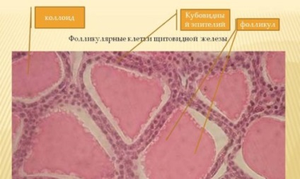 Guiderul coloidal al glandei tiroide ce este, tratamentul (remedii folclorice, chirurgie), nutriție și