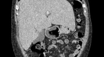 Diagnosticul CT al ficatului - descrierea și adresele centrelor medicale