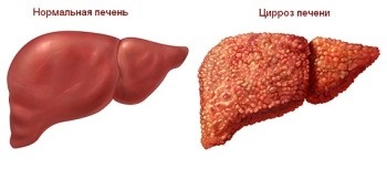 Diagnosticul CT al ficatului - descrierea și adresele centrelor medicale