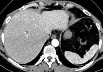 Diagnosticul CT al ficatului - descrierea și adresele centrelor medicale