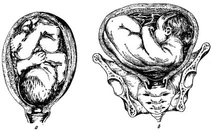 Etapele inițiale ale dezvoltării embrionului uman 1970 gusev a