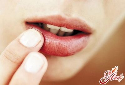 Remedii populare pentru herpes