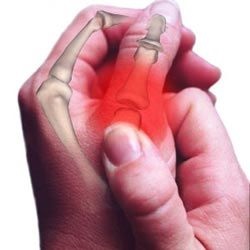 Deteriorarea aparatului ligamentos al mâinii