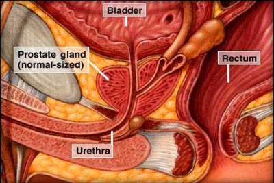 Prostatita și alcoolul, care nu sunt posibile cu inflamarea prostatei