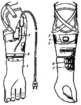 A protézis az alkar bioelektromos ellenőrzése két funkció