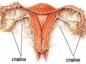 Termenul pe care tubul izbucnește cu sarcină ectopică cauzează tubul