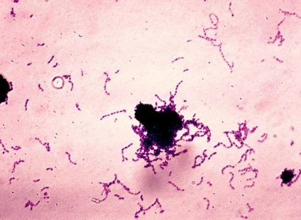 Streptococcus viridans caracteristic patogenului și infecției