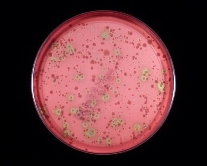 Streptococcus viridans caracteristic patogenului și infecției