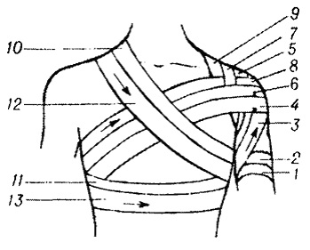 Bandaje tipice pe abdomen, perineu, membre