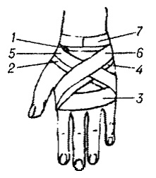 Bandaje tipice pe abdomen, perineu, membre