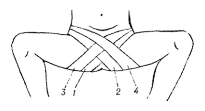 Bandaje tipice pe abdomen, perineu, membre