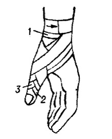 Bandaje tipice pe abdomen, perineu, membre