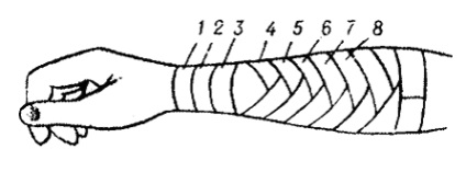 Bandaje tipice pe abdomen, perineu, membre