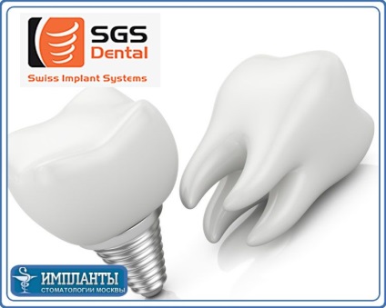 Állítsa SGS implantátumok a fogászatban - implantátum behelyezése GHS, Made in Switzerland