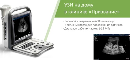 Uzi acasă în samara uzi cavitatea abdominală la domiciliu, uzi ginecologic la domiciliu
