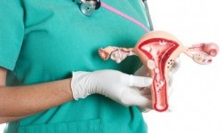 Răzuirea polipului endometrial în uterul trăsăturii