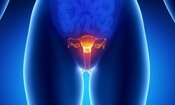 Răzuirea polipului endometrial în uterul trăsăturii