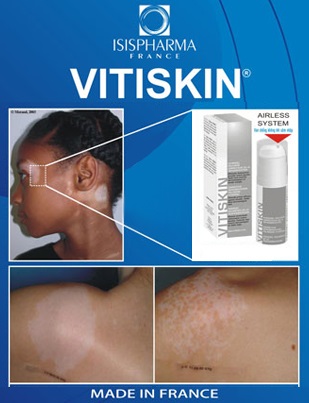 Vitiskin - un nou cuvânt în tratamentul vitiligo