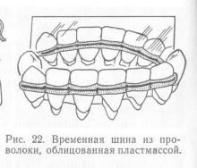 Sindromul temporar în bolile parodontale, parodontita și parodontita, tratamentul bolilor