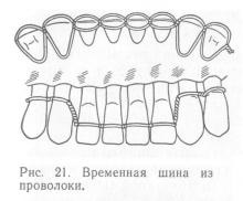 Ideiglenes sínezés a periodontális betegségek, periodontális betegség és a periodontitis, betegségek kezelésére