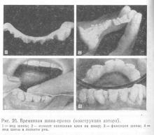 Ideiglenes sínezés a periodontális betegségek, periodontális betegség és a periodontitis, betegségek kezelésére