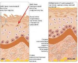 Peeling chimic al feței și corpului la domiciliu