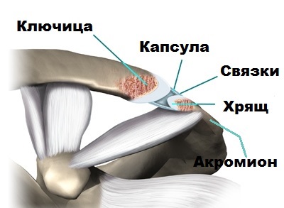 Osteoarthritis a váll ízület és acromioclavicular közös acromioclavicular (ax)