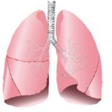 Diagnosticul și tratamentul mioplasmozelor pulmonare - bisturiu - medical