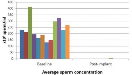 Gel pentru contracepția masculină