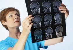 Hidrocefalia creierului la copii, știri despre copii